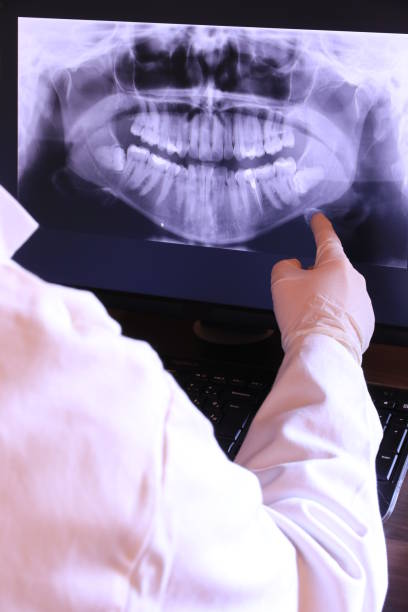 Best Emergency Dental Care for Broken or Chipped Teeth in Pleasant Hill, MO
